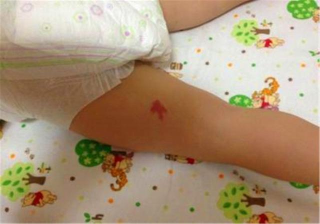 身上的胎记与前世，胎记的传说与前世（听说胎记暗示“前世死法”）