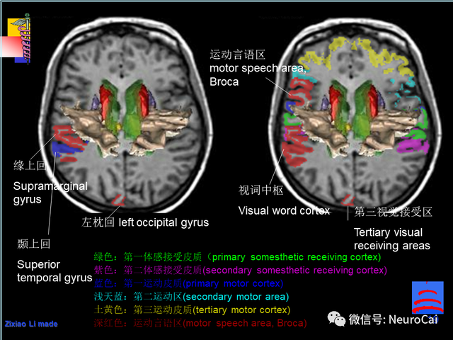 大脑结构图及功能图，人类大脑十大三维解剖图（脑局部解剖与功能图谱）