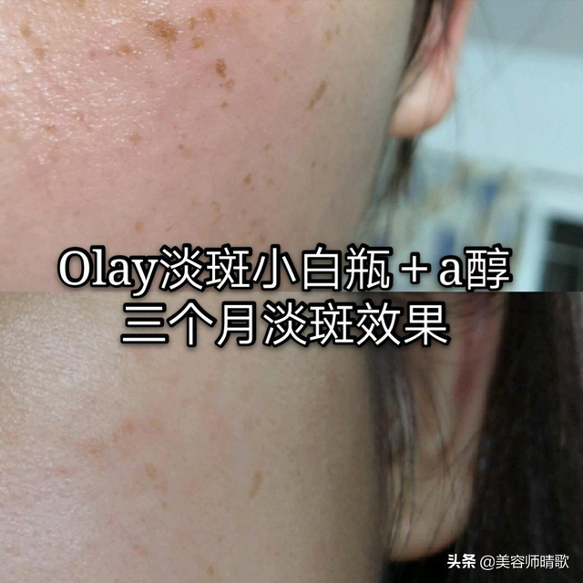 377美白精华，野城医生377vc美白精华怎么用（美白精华大盘点 ）