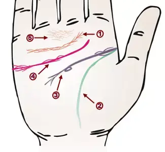 掌纹诊病实用图谱，看看你的掌纹：预示者不同疾病（可以诊断肝癌、糖尿病、高血压、妇科病、脑溢血）