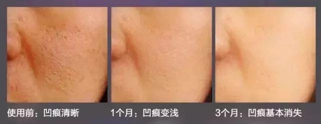 冻干粉用在护肤的哪个步骤，冻干粉免洗面膜效果怎么样（冻干粉是什么，有什么作用）