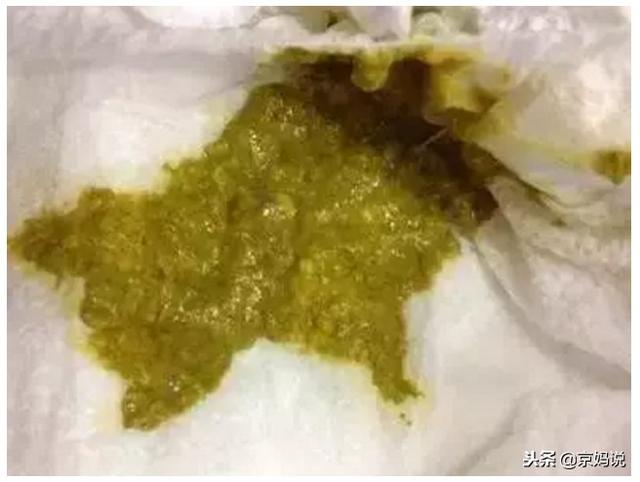 一个月的宝宝拉绿色大便什么原因，满月婴儿大便呈绿色是怎么回事（宝宝拉绿便的6个常见原因）
