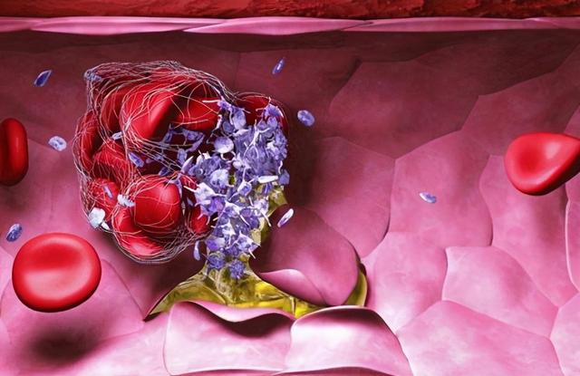 胆红素偏高的原因及危害，胆红素偏高的危害是什么（什么原因会引起胆红素的升高）