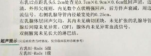 2,報告顯示4級乳腺結節,我是不是沒救了?