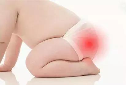 宝宝屁股红怎么办，三个关键词让宝妈不再烦恼