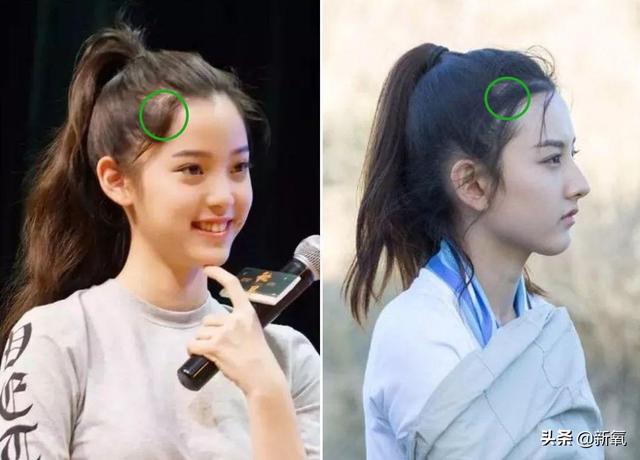 发际线粉会堵塞毛孔吗，发际线粉的危害（关晓彤才23岁就秃了）