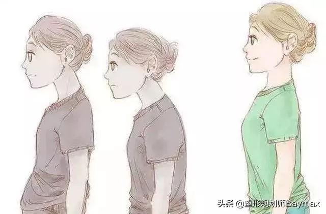 怎么改善驼背，驼背怎么办，怎么改善驼背（6个动作让你恢复挺拔完美体态）