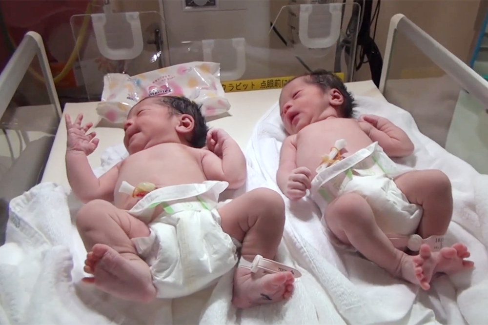 亲子鉴定案例（活久见）