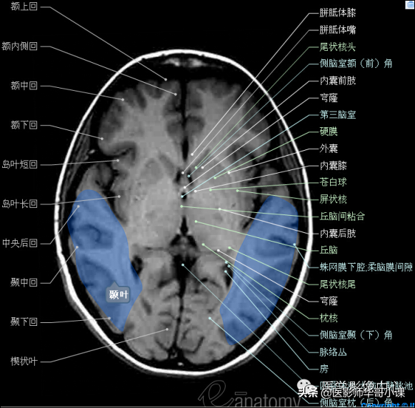 颅脑mri(头部MRI)插图(32)