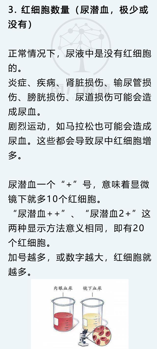 尿常规怎么检查，男性尿常规怎么看（5分钟判断身体健康）