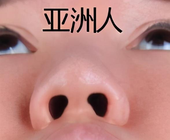 鼻头太大怎么办，鼻子大怎么才能小下来（如何改善鼻头肥大）