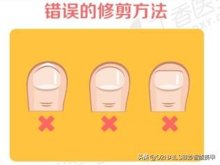 晚上可以剪指甲吗，晚上可以剪手指甲和脚趾甲吗（原来晚上不可以剪指甲的原因是这个）