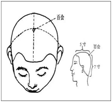 三个穴位帮您解决烦恼，总打嗝胃胀是什么原因（艾灸这3穴为何可以改善记忆力）