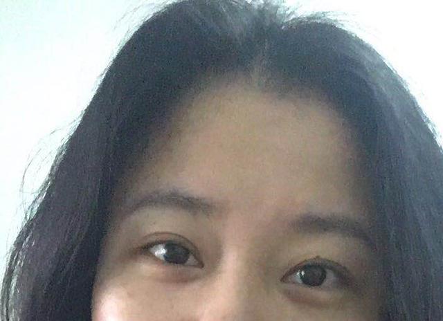 激光脱毛一次后悔了，激光脱毛6年后后悔了（你后悔做近视激光手术了吗）