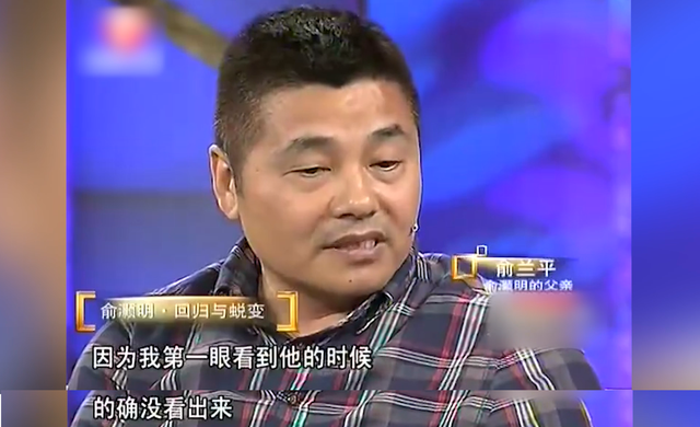 俞灏明：22岁意外烧伤毁容，《八佰》中终于露出了满身伤疤