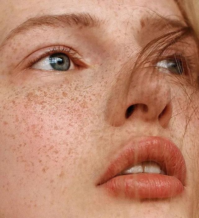 戴口罩会闷痘痘吗，长期戴口罩会不会捂出痘痘（开启紧急防护戳这里）