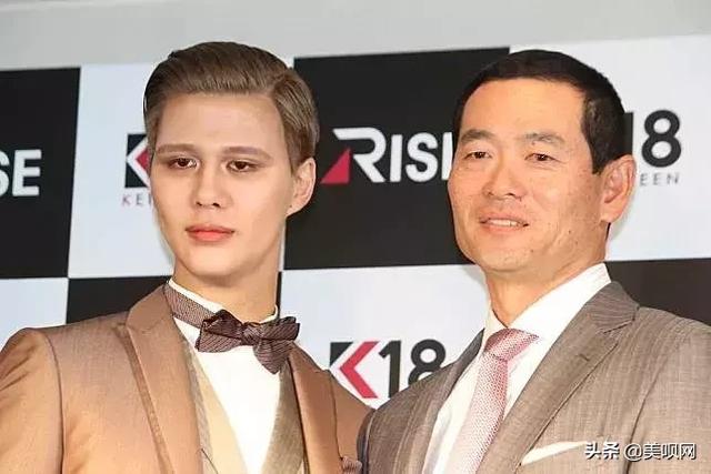 刘梓晨面部填充，日本星二代突变刘梓晨同款“蛇精脸”