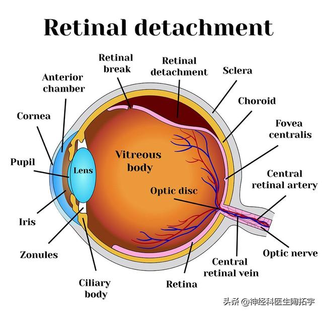 眼睛构造详细图解，人体解剖：眼睛及常见疾病