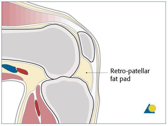 护膝的作用有哪些，护膝的作用有哪些功效（市面上多种护膝如何选择）