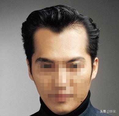 发际线粉会堵塞毛孔吗，发际线粉的危害（关晓彤才23岁就秃了）