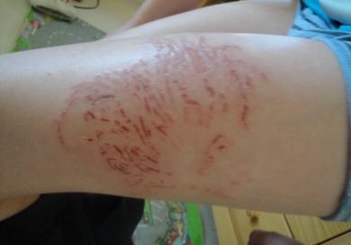 世界上最毒的水母，十种危险水母（澳大利亚箱形水母为什么会是全球最毒生物）