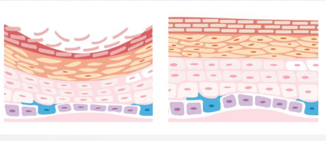 olay淡斑小白瓶，olay淡斑小白瓶真能祛斑吗（OLAY小白瓶和科颜氏淡斑精华对比测评）