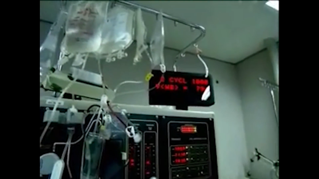 大内久83天活体腐烂图片，大内久83天活体腐烂是什么（大内久与核辐射战斗了83天）