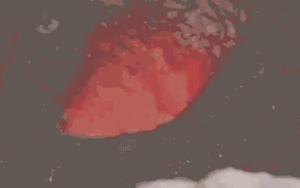 经痛是什么，肋间神经痛是什么（姨妈疼究竟是一种什么样的痛）