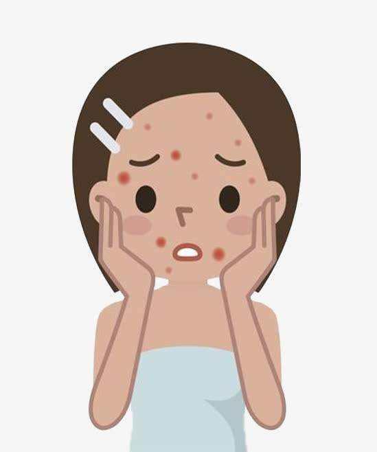 鼻尖长痘如何消除，鼻尖长痘如何消除小妙招（两个小妙招教你轻松去除）