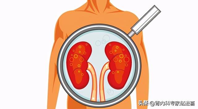 肌酐值多少正常，人的肌酐多少为正常（肌酐达到多少就需要做透析了）