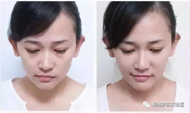 泥奏凯是什么意思，皱纹小百科-泪沟，泥奏凯