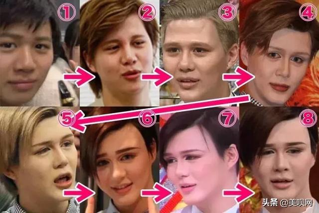 刘梓晨面部填充，日本星二代突变刘梓晨同款“蛇精脸”