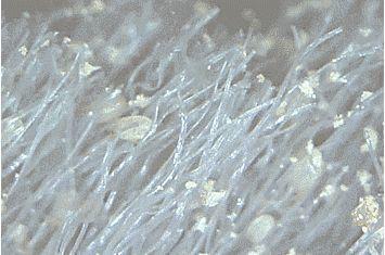 小螨虫的危害有多大，小小的螨虫对人体的危害有多大