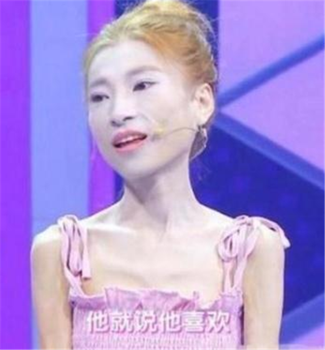 绝食半个月的成功案例（安格斯的减肥传奇）