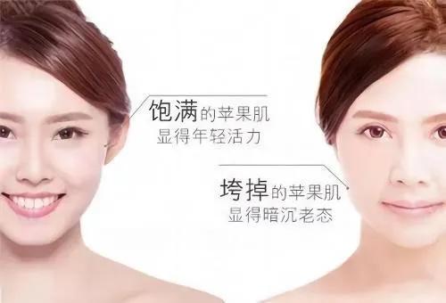 标准的苹果肌图片，美人胚子的几大特点和标准（“塑胶味儿”的苹果肌）
