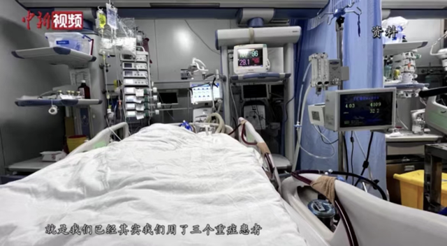 中国国产ecmo进入临床阶段，国内多少医院能做ECMO（国产ECMO进入临床阶段）