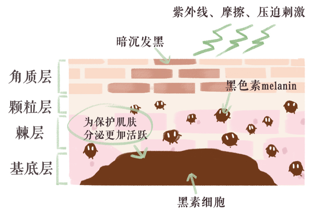 胳膊上黑色素沉淀图片，后背黑色素沉淀怎么去除（膝盖、腋下、大腿根黑黑一块不好看）