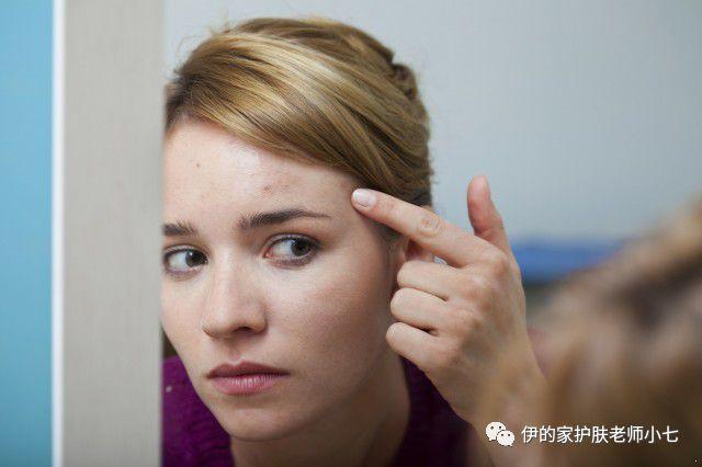 去除闭合性粉刺小妙招，闭合性粉刺如何治粉刺怎么去除小妙招用什么有效（脸上闭合粉刺怎么去除）