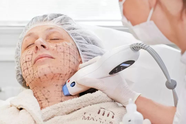 热玛吉是什么东西,热吉马是什么还是热玛吉(超90%医疗