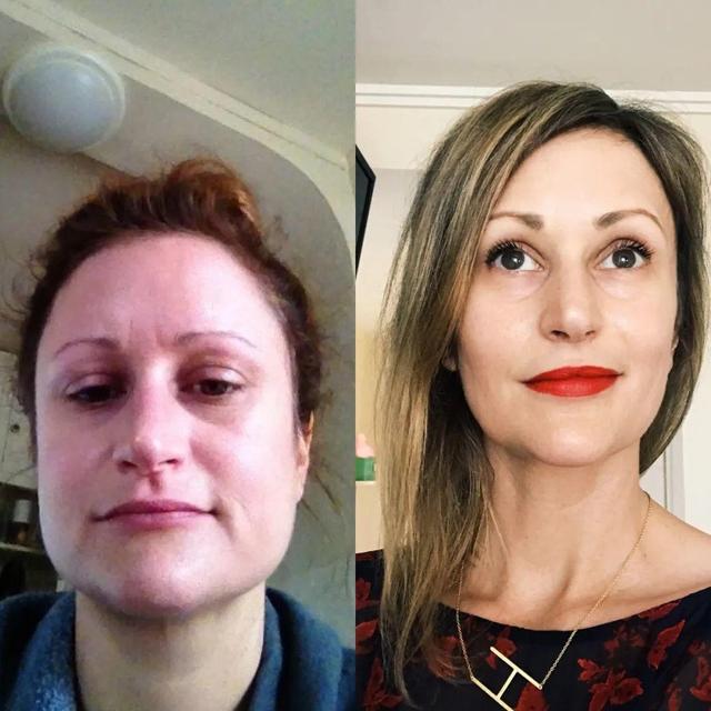 脸肿是什么原因引起的，半边脸肿是什么原因引起的（为什么早上脸会变肿）