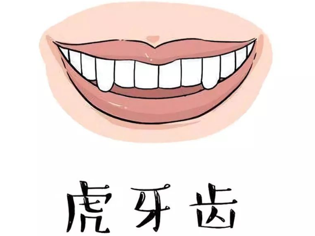为什么会长虎牙，人为什么会长虎牙（长了会对其它牙齿有影响吗）