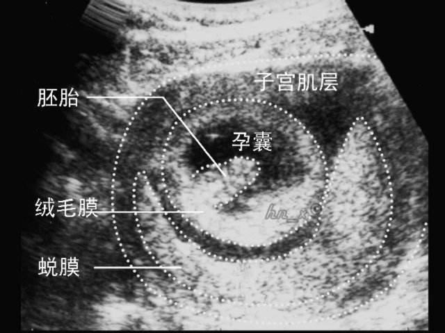 测试怀孕的方法，四个方法测怀孕准爆（看表现、用工具、做检查）