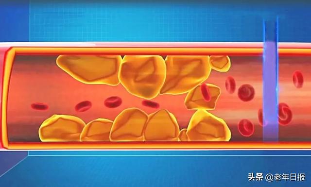 耳皮读什么意思是什么，耳朵皮读什么（降压、健脑、补肾精……别错过）