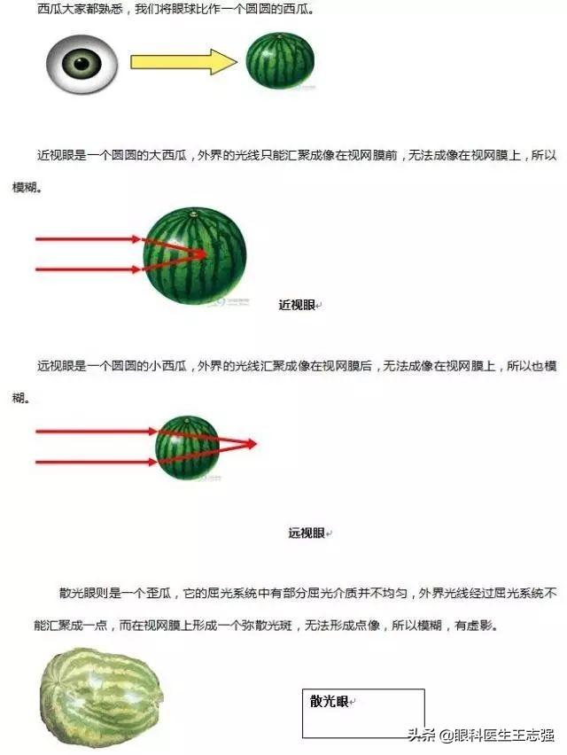 什么是散光眼，什么是散光眼,需要怎么治疗（什么是“散光”）