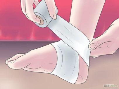 变向是什么意思，xxs是什么意思（每个跑友都应该看一看的崴脚知识）