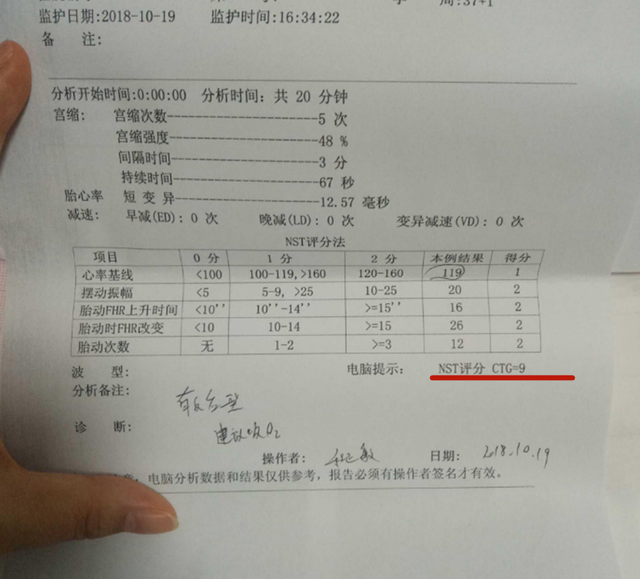 胎心监护图怎么看，看胎心监护图时，记住这5个关键数值！（自己就能了解胎儿的健康情况）
