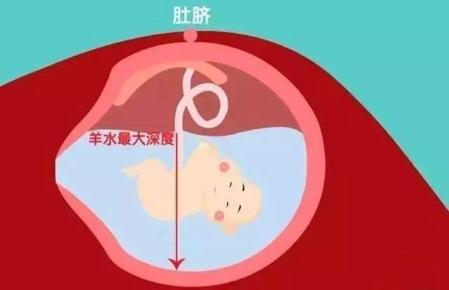 10分钟看懂四维，检查报告的这几点能看懂