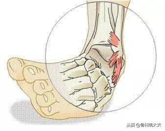 冰敷消肿一般要多久，冰敷消肿一般要多久才可以热敷（用冰块冰敷消肿立竿见影）