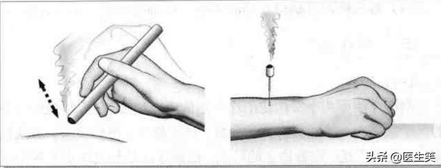 刮痧的作用和功效 刮痧是泄气还是补气，刮痧的作用和功效（湿气的故事——掌握居家健脾祛湿小妙招）