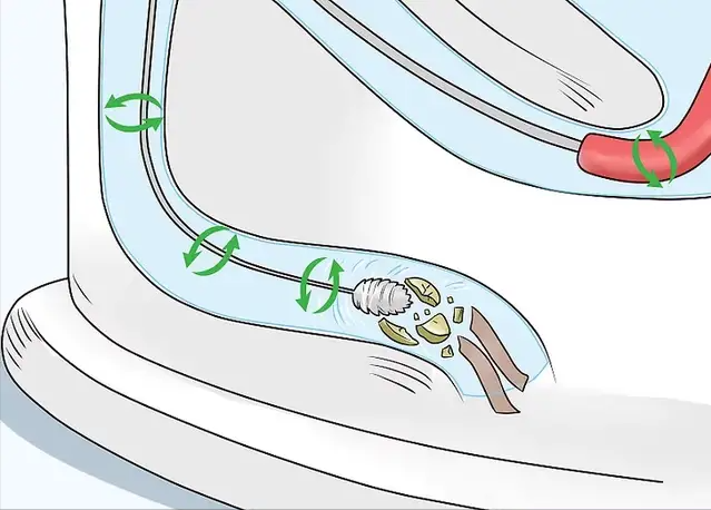 坐便器下水道堵塞疏通小妙招，坐便器堵塞疏通的最好办法（利用常见的4种日用品及方法即可疏通）
